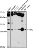 Western blot analysis of extracts of various cell lines, using MSX2 antibody (18-450) at 1:1000 dilution.<br/>Secondary antibody: HRP Goat Anti-Rabbit IgG (H+L) at 1:10000 dilution.<br/>Lysates/proteins: 25ug per lane.<br/>Blocking buffer: 3% nonfat dry milk in TBST.<br/>Detection: ECL Enhanced Kit.<br/>Exposure time: 10s.