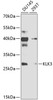 Western blot analysis of extracts of various cell lines, using KLK3 antibody (18-468) at 1:1000 dilution.<br/>Secondary antibody: HRP Goat Anti-Rabbit IgG (H+L) at 1:10000 dilution.<br/>Lysates/proteins: 25ug per lane.<br/>Blocking buffer: 3% nonfat dry milk in TBST.<br/>Detection: ECL Basic Kit.<br/>Exposure time: 10s.