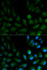 Immunofluorescence analysis of HepG2 cells using CAPZA2 antibody (18-469) . Blue: DAPI for nuclear staining.