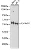 Western blot analysis of extracts of various cell lines, using Cyclin B1 Antibody (18-470) at 1:1000 dilution.<br/>Secondary antibody: HRP Goat Anti-Rabbit IgG (H+L) at 1:10000 dilution.<br/>Lysates/proteins: 25ug per lane.<br/>Blocking buffer: 3% nonfat dry milk in TBST.<br/>Detection: ECL Basic Kit.
