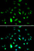 Immunofluorescence analysis of A549 cells using Cyclin B1 antibody (18-470) . Blue: DAPI for nuclear staining.