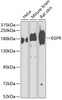 Western blot analysis of extracts of various cell lines, using EGFR antibody (18-478) at 1:1000 dilution.<br/>Secondary antibody: HRP Goat Anti-Rabbit IgG (H+L) at 1:10000 dilution.<br/>Lysates/proteins: 25ug per lane.<br/>Blocking buffer: 3% nonfat dry milk in TBST.<br/>Detection: ECL Basic Kit.<br/>Exposure time: 90s.