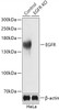 Western blot analysis of extracts from normal (control) and EGFR knockout (KO) HeLa cells, using EGFR antibody (18-478) at 1:3000 dilution.<br/>Secondary antibody: HRP Goat Anti-Rabbit IgG (H+L) at 1:10000 dilution.<br/>Lysates/proteins: 25ug per lane.<br/>Blocking buffer: 3% nonfat dry milk in TBST.<br/>Detection: ECL Basic Kit.<br/>Exposure time: 1s.