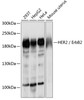 Western blot analysis of extracts of various cell lines, using HER2 / ErbB2 antibody (18-479) at 1:500 dilution.<br/>Secondary antibody: HRP Goat Anti-Rabbit IgG (H+L) at 1:10000 dilution.<br/>Lysates/proteins: 25ug per lane.<br/>Blocking buffer: 3% nonfat dry milk in TBST.<br/>Detection: ECL Basic Kit.<br/>Exposure time: 90s.
