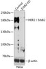 Western blot analysis of extracts from normal (control) and HER2 / ErbB2 knockout (KO) HeLa cells, using HER2 / ErbB2 antibody (18-479) at 1:500 dilution.<br/>Secondary antibody: HRP Goat Anti-Rabbit IgG (H+L) at 1:10000 dilution.<br/>Lysates/proteins: 25ug per lane.<br/>Blocking buffer: 3% nonfat dry milk in TBST.<br/>Detection: ECL Basic Kit.<br/>Exposure time: 5min.