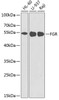 Western blot analysis of extracts of various cell lines, using FGR antibody (18-481) at 1:1000 dilution._Secondary antibody: HRP Goat Anti-Rabbit IgG (H+L) at 1:10000 dilution._Lysates/proteins: 25ug per lane._Blocking buffer: 3% nonfat dry milk in TBST._Detection: ECL Enhanced Kit._Exposure time: 90s.