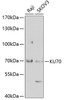 Western blot analysis of extracts of various cell lines, using KU70 antibody (18-482) at 1:1000 dilution.<br/>Secondary antibody: HRP Goat Anti-Rabbit IgG (H+L) at 1:10000 dilution.<br/>Lysates/proteins: 25ug per lane.<br/>Blocking buffer: 3% nonfat dry milk in TBST.<br/>Detection: ECL Basic Kit.<br/>Exposure time: 90s.