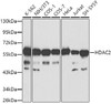 Western blot analysis of extracts of various cell lines, using HDAC2 antibody (18-488) at 1:1000 dilution.<br/>Secondary antibody: HRP Goat Anti-Rabbit IgG (H+L) at 1:10000 dilution.<br/>Lysates/proteins: 25ug per lane.<br/>Blocking buffer: 3% nonfat dry milk in TBST.