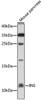 Western blot analysis of extracts of mouse pancreas, using INS antibody (18-492) at 1:1000 dilution.<br/>Secondary antibody: HRP Goat Anti-Rabbit IgG (H+L) at 1:10000 dilution.<br/>Lysates/proteins: 25ug per lane.<br/>Blocking buffer: 3% nonfat dry milk in TBST.<br/>Detection: ECL Enhanced Kit.<br/>Exposure time: 30s.