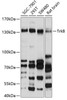 Western blot analysis of extracts of various cell lines, using TrkB antibody (18-499) at 1:1000 dilution.<br/>Secondary antibody: HRP Goat Anti-Rabbit IgG (H+L) at 1:10000 dilution.<br/>Lysates/proteins: 25ug per lane.<br/>Blocking buffer: 3% nonfat dry milk in TBST.<br/>Detection: ECL Basic Kit.<br/>Exposure time: 15s.