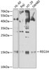 Western blot analysis of extracts of various cell lines, using REG3A antibody (18-501) at 1:1000 dilution.<br/>Secondary antibody: HRP Goat Anti-Rabbit IgG (H+L) at 1:10000 dilution.<br/>Lysates/proteins: 25ug per lane.<br/>Blocking buffer: 3% nonfat dry milk in TBST.<br/>Detection: ECL Enhanced Kit.<br/>Exposure time: 30s.