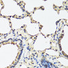 Immunohistochemistry of paraffin-embedded rat lung using REG3A antibody (18-501) at dilution of 1:100 (40x lens) .