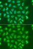 Immunofluorescence analysis of A549 cells using POLR2A antibody (18-506) .