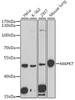 Western blot analysis of extracts of various cell lines, using MAPK7 antibody (18-510) at 1:1000 dilution.<br/>Secondary antibody: HRP Goat Anti-Rabbit IgG (H+L) at 1:10000 dilution.<br/>Lysates/proteins: 25ug per lane.<br/>Blocking buffer: 3% nonfat dry milk in TBST.