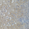 Immunohistochemistry of paraffin-embedded human esophagus using FAK antibody (18-512) at dilution of 1:100 (40x lens) .