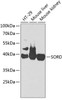 Western blot analysis of extracts of various cell lines, using SORD antibody (18-514) at 1:1000 dilution.<br/>Secondary antibody: HRP Goat Anti-Rabbit IgG (H+L) at 1:10000 dilution.<br/>Lysates/proteins: 25ug per lane.<br/>Blocking buffer: 3% nonfat dry milk in TBST.