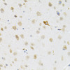 Immunohistochemistry of paraffin-embedded mouse brain using SYK Antibody (18-517) at dilution of 1:100 (40x lens) .