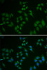 Immunofluorescence analysis of U2OS cells using TP63 antibody (18-527) . Blue: DAPI for nuclear staining.