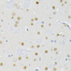 Immunohistochemistry of paraffin-embedded rat brain using ATF2 antibody (18-540) at dilution of 1:200 (40x lens) .
