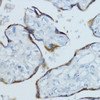 Immunohistochemistry of paraffin-embedded human placenta using Aromatase antibody (18-546) at dilution of 1:100 (40x lens) .