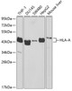 Western blot analysis of extracts of various cell lines, using HLA-A antibody (18-549) at 1:1000 dilution.<br/>Secondary antibody: HRP Goat Anti-Rabbit IgG (H+L) at 1:10000 dilution.<br/>Lysates/proteins: 25ug per lane.<br/>Blocking buffer: 3% nonfat dry milk in TBST.
