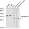 Western blot analysis of extracts of various cell lines, using HLA-DQA1 antibody (18-550) at 1:1000 dilution.<br/>Secondary antibody: HRP Goat Anti-Rabbit IgG (H+L) at 1:10000 dilution.<br/>Lysates/proteins: 25ug per lane.<br/>Blocking buffer: 3% nonfat dry milk in TBST.