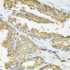 Immunohistochemistry of paraffin-embedded human prostate using HLA-DQA1 antibody (18-550) at dilution of 1:100 (40x lens) .