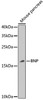 Western blot analysis of extracts of mouse pancreas, using BNP antibody (18-554) at 1:1000 dilution.<br/>Secondary antibody: HRP Goat Anti-Rabbit IgG (H+L) at 1:10000 dilution.<br/>Lysates/proteins: 25ug per lane.<br/>Blocking buffer: 3% nonfat dry milk in TBST.<br/>Detection: ECL Enhanced Kit.<br/>Exposure time: 30s.