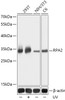 Western blot analysis of extracts of various cell lines, using RPA2 antibody (18-562) at 1:1000 dilution. 293T cells were treated by UV at room temperature for 15-30 minutes.<br/>Secondary antibody: HRP Goat Anti-Rabbit IgG (H+L) at 1:10000 dilution.<br/>Lysates/proteins: 25ug per lane.<br/>Blocking buffer: 3% nonfat dry milk in TBST.<br/>Detection: ECL Basic Kit.<br/>Exposure time: 10s.