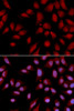 Immunofluorescence analysis of U2OS cells using DLGAP5 antibody (18-568) . Blue: DAPI for nuclear staining.