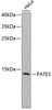 Western blot analysis of extracts of HeLa cells, using PATE3 antibody (18-571) .<br/>Secondary antibody: HRP Goat Anti-Rabbit IgG (H+L) at 1:10000 dilution.<br/>Lysates/proteins: 25ug per lane.<br/>Blocking buffer: 3% nonfat dry milk in TBST.