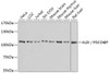 Western blot analysis of extracts of various cell lines, using ALIX / PDCD6IP antibody (18-578) at 1:1000 dilution.<br/>Secondary antibody: HRP Goat Anti-Rabbit IgG (H+L) at 1:10000 dilution.<br/>Lysates/proteins: 25ug per lane.<br/>Blocking buffer: 3% nonfat dry milk in TBST.<br/>Detection: ECL Enhanced Kit.<br/>Exposure time: 3min.
