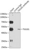 Immunoprecipitation analysis of 150ug extracts of HeLa cells using 3ug TSG101 antibody (18-579) . Western blot was performed from the immunoprecipitate using TSG101 antibody (18-579) at a dilition of 1:1000.