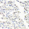 Immunohistochemistry of paraffin-embedded human stomach using CBX1 antibody (18-587) at dilution of 1:100 (40x lens) .