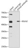 Immunoprecipitation analysis of 150ug extracts of HeLa cells using 3ug EGLN2 antibody (18-590) . Western blot was performed from the immunoprecipitate using EGLN2 antibody (18-590) at a dilition of 1:1000.