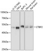 Western blot analysis of extracts of various cell lines, using CTBP2 Antibody (18-592) at 1:3000 dilution.<br/>Secondary antibody: HRP Goat Anti-Rabbit IgG (H+L) at 1:10000 dilution.<br/>Lysates/proteins: 25ug per lane.<br/>Blocking buffer: 3% nonfat dry milk in TBST.<br/>Detection: ECL Basic Kit.<br/>Exposure time: 1s.