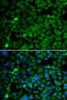 Immunofluorescence analysis of MCF-7 cells using SMYD4 antibody (18-610) . Blue: DAPI for nuclear staining.