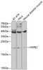 Western blot analysis of extracts of various cell lines, using HSPB2 antibody (18-616) at 1:1000 dilution.<br/>Secondary antibody: HRP Goat Anti-Rabbit IgG (H+L) at 1:10000 dilution.<br/>Lysates/proteins: 25ug per lane.<br/>Blocking buffer: 3% nonfat dry milk in TBST.