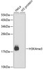 Western blot analysis of extracts of various cell lines, using TriMethyl-Histone H3-K4 antibody (18-620) .<br/>Secondary antibody: HRP Goat Anti-Rabbit IgG (H+L) at 1:10000 dilution.<br/>Lysates/proteins: 25ug per lane.<br/>Blocking buffer: 3% nonfat dry milk in TBST.