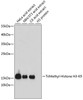 Western blot analysis of extracts of various cell lines, using TriMethyl-Histone H3-K9 antibody (18-623) at 1:1000 dilution.<br/>Secondary antibody: HRP Goat Anti-Rabbit IgG (H+L) at 1:10000 dilution.<br/>Lysates/proteins: 25ug per lane.<br/>Blocking buffer: 3% nonfat dry milk in TBST.<br/>Detection: ECL Basic Kit.<br/>Exposure time: 5s.