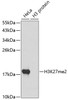 Western blot analysis of extracts of various cell lines, using DiMethyl-Histone H3-K27 antibody (18-625) .<br/>Secondary antibody: HRP Goat Anti-Rabbit IgG (H+L) at 1:10000 dilution.<br/>Lysates/proteins: 25ug per lane.<br/>Blocking buffer: 3% nonfat dry milk in TBST.