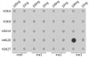 Dot-blot analysis of all sorts of methylation peptides using TriMethyl-Histone H4-K20 antibody (18-635) .