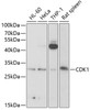 Western blot analysis of extracts of various cell lines, using CDK1 antibody (18-647) at 1:1000 dilution.<br/>Secondary antibody: HRP Goat Anti-Rabbit IgG (H+L) at 1:10000 dilution.<br/>Lysates/proteins: 25ug per lane.<br/>Blocking buffer: 3% nonfat dry milk in TBST.<br/>Detection: ECL Enhanced Kit.<br/>Exposure time: 60s.