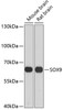 Western blot analysis of extracts of various cell lines, using SOX9 antibody (18-660) at 1:1000 dilution.<br/>Secondary antibody: HRP Goat Anti-Rabbit IgG (H+L) at 1:10000 dilution.<br/>Lysates/proteins: 25ug per lane.<br/>Blocking buffer: 3% nonfat dry milk in TBST.<br/>Detection: ECL Basic Kit.<br/>Exposure time: 40s.