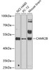 Western blot analysis of extracts of various cell lines, using CAMK2B antibody (18-677) at 1:1000 dilution.<br/>Secondary antibody: HRP Goat Anti-Rabbit IgG (H+L) at 1:10000 dilution.<br/>Lysates/proteins: 25ug per lane.<br/>Blocking buffer: 3% nonfat dry milk in TBST.<br/>Detection: ECL Basic Kit.<br/>Exposure time: 90s.