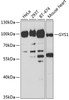 Western blot analysis of extracts of various cell lines, using GYS1 antibody (18-683) at 1:1000 dilution.<br/>Secondary antibody: HRP Goat Anti-Rabbit IgG (H+L) at 1:10000 dilution.<br/>Lysates/proteins: 25ug per lane.<br/>Blocking buffer: 3% nonfat dry milk in TBST.<br/>Detection: ECL Basic Kit.<br/>Exposure time: 30s.