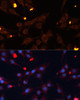 Immunofluorescence analysis of C6 cells using ADAMTS4 Polyclonal Antibody (18-689) at dilution of 1:100 (40x lens) . Blue: DAPI for nuclear staining.