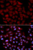 Immunofluorescence analysis of U2OS cells using TNK2 antibody (18-690) . Blue: DAPI for nuclear staining.