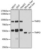 Western blot analysis of extracts of various cell lines, using TMPO antibody (18-696) at 1:1000 dilution.<br/>Secondary antibody: HRP Goat Anti-Rabbit IgG (H+L) at 1:10000 dilution.<br/>Lysates/proteins: 25ug per lane.<br/>Blocking buffer: 3% nonfat dry milk in TBST.<br/>Detection: ECL Basic Kit.<br/>Exposure time: 30s.