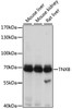 Western blot analysis of extracts of various cell lines, using TNXB antibody (18-697) at 1:1000 dilution.<br/>Secondary antibody: HRP Goat Anti-Rabbit IgG (H+L) at 1:10000 dilution.<br/>Lysates/proteins: 25ug per lane.<br/>Blocking buffer: 3% nonfat dry milk in TBST.<br/>Detection: ECL Basic Kit.<br/>Exposure time: 1s.